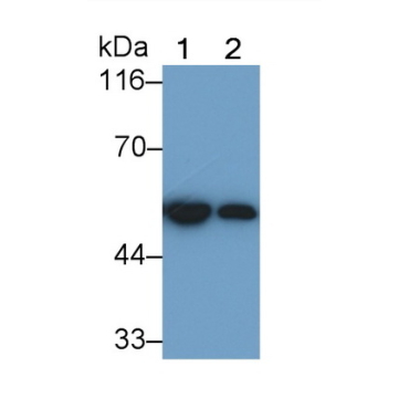 Glial Fibrillary Acidic Protein (GFAP) Mouse Polyclonal Antibody