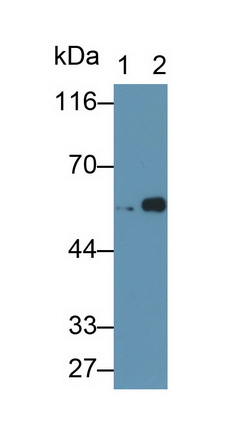 Glial Fibrillary Acidic Protein (GFAP) Rat Polyclonal Antibody