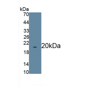 Meningioma Expressed Antigen 5 (MGEA5) Bovine (Cattle) Polyclonal Antibody