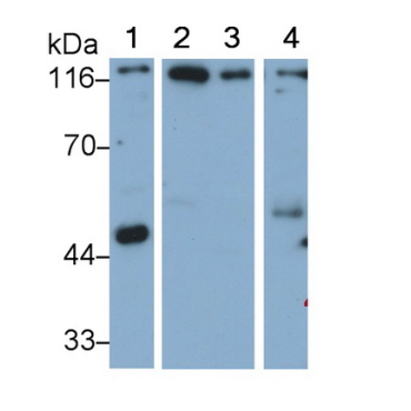 Meningioma Expressed Antigen 5 (MGEA5) Human Polyclonal Antibody