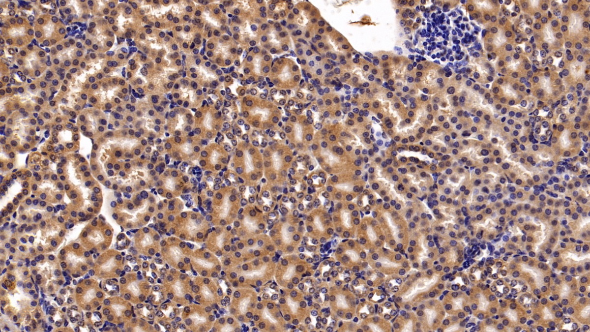Meningioma Expressed Antigen 5 (MGEA5) Human Polyclonal Antibody
