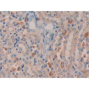 Meningioma Expressed Antigen 5 (MGEA5) Mouse Polyclonal Antibody