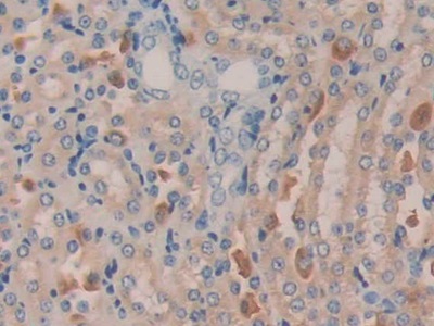 Meningioma Expressed Antigen 5 (MGEA5) Mouse Polyclonal Antibody