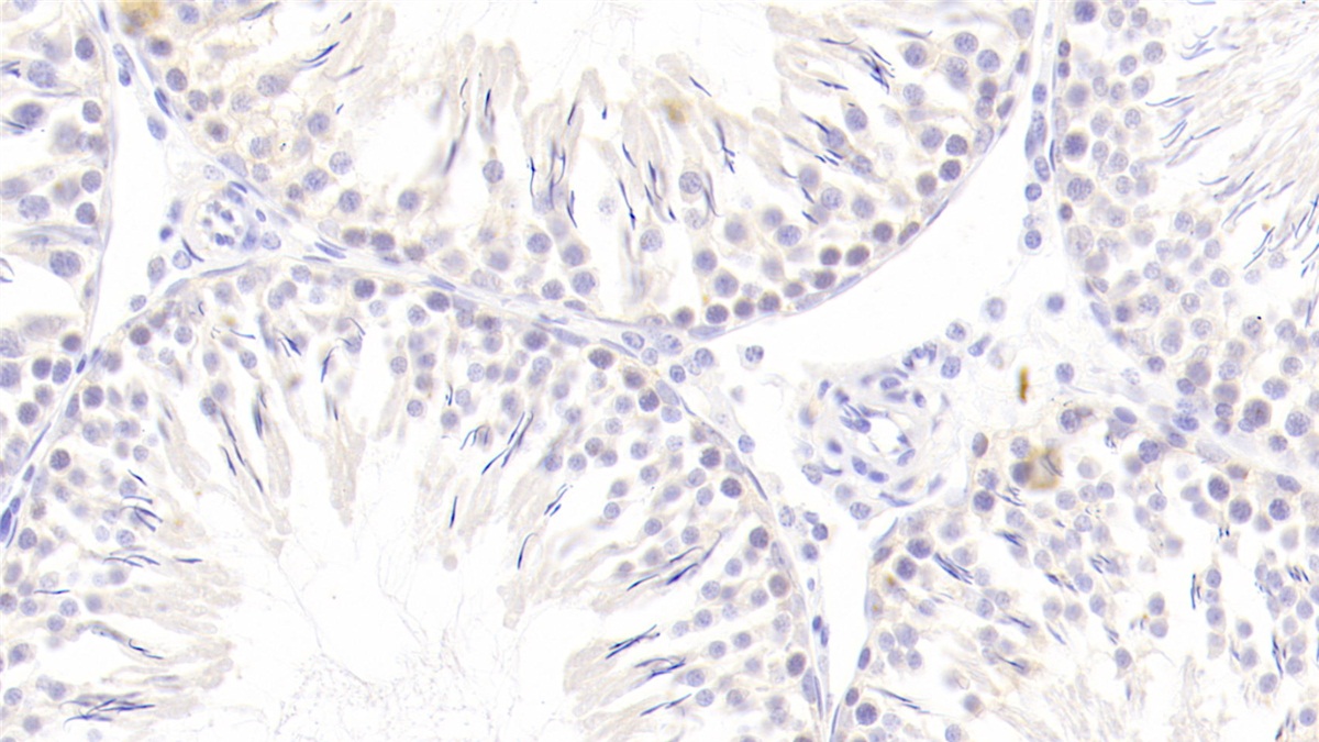 Meningioma Expressed Antigen 5 (MGEA5) Rat Polyclonal Antibody
