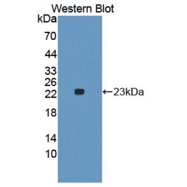 Interleukin 1 Alpha (IL1a) Human Polyclonal Antibody
