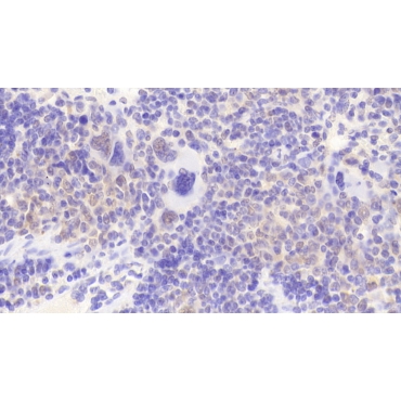 Interleukin 1 Alpha (IL1a) Mouse Polyclonal Antibody