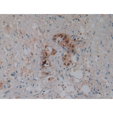 Defensin Beta 2 (DEFb2) Human Polyclonal Antibody