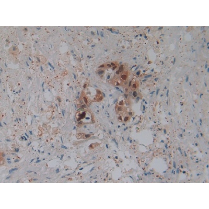 Defensin Beta 2 (DEFb2) Human Polyclonal Antibody