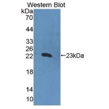 Interleukin 2 (IL2) Chicken (Gallus) Polyclonal Antibody
