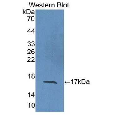 Interleukin 2 (IL2) Human Polyclonal Antibody