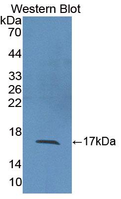 Interleukin 2 (IL2) Human Polyclonal Antibody