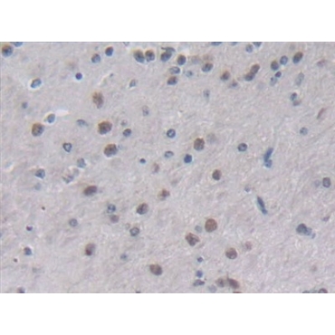 Interleukin 2 (IL2) Mouse Polyclonal Antibody