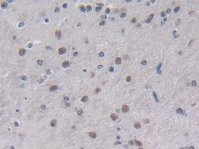 Interleukin 2 (IL2) Mouse Polyclonal Antibody