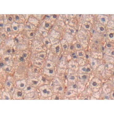Interleukin 4 (IL4) Human Polyclonal Antibody