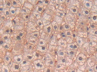 Interleukin 4 (IL4) Human Polyclonal Antibody