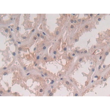 Interleukin 5 (IL5) Human Polyclonal Antibody