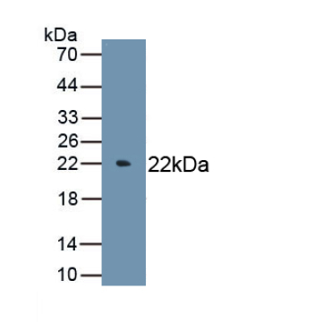 Interleukin 6 (IL6) Chicken (Gallus) Polyclonal Antibody