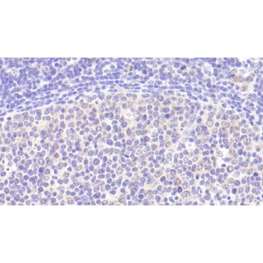 Interleukin 6 (IL6) Human Polyclonal Antibody