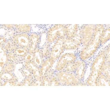 Leptin Receptor (LEPR) Human Polyclonal Antibody