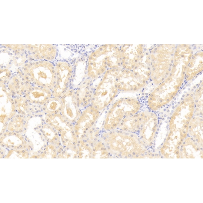 Leptin Receptor (LEPR) Human Polyclonal Antibody