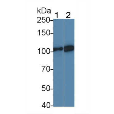 Leptin Receptor (LEPR) Mouse Polyclonal Antibody