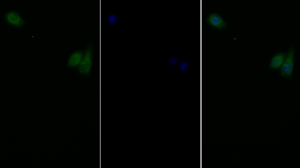 Leptin Receptor (LEPR) Rat Polyclonal Antibody