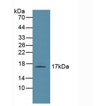 Leptin (LEP) Human Polyclonal Antibody