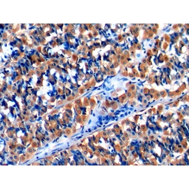 Monocyte Chemotactic Protein 1 (MCP1) Human Polyclonal Antibody