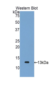 Monocyte Chemotactic Protein 1 (MCP1) Rabbit Polyclonal Antibody