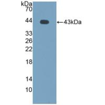 Monocyte Chemotactic Protein 2 (MCP2) Bovine (Cattle) Polyclonal Antibody