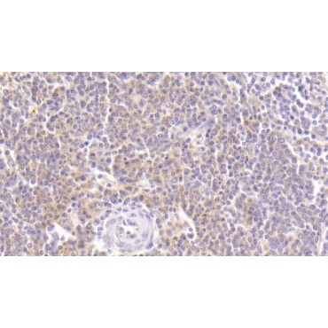 Macrophage Derived Chemokine (MDC) Human Polyclonal Antibody