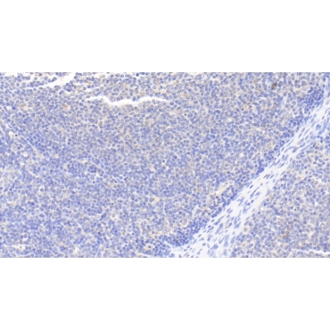 Macrophage Inflammatory Protein 1 Alpha (MIP1a) Human Polyclonal Antibody