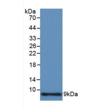 Macrophage Inflammatory Protein 1 Alpha (MIP1a) Human Polyclonal Antibody