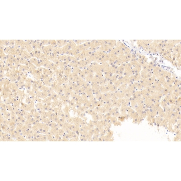 Macrophage Inflammatory Protein 1 Beta (MIP1b) Human Polyclonal Antibody