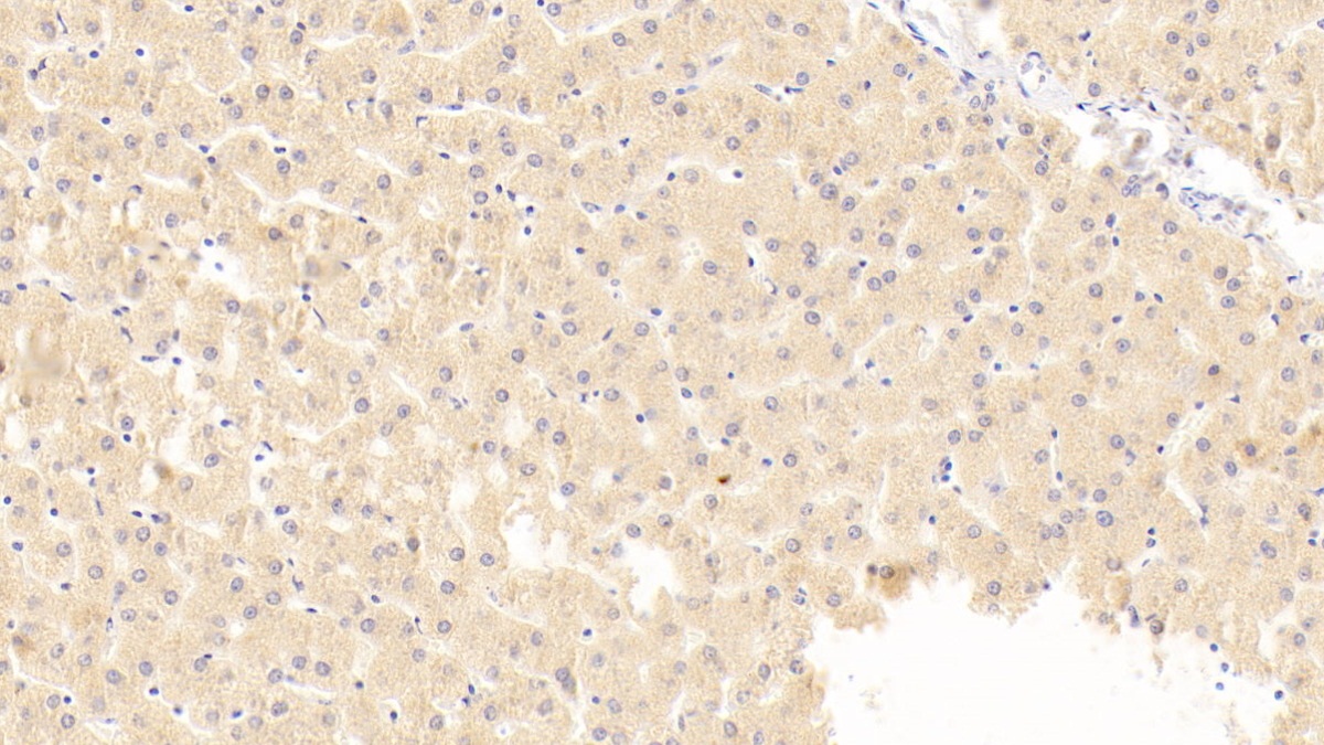 Macrophage Inflammatory Protein 1 Beta (MIP1b) Human Polyclonal Antibody