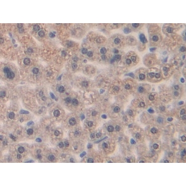 Macrophage Inflammatory Protein 1 Beta (MIP1b) Mouse Polyclonal Antibody