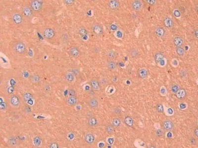Macrophage Inflammatory Protein 1 Beta (MIP1b) Rat Polyclonal Antibody