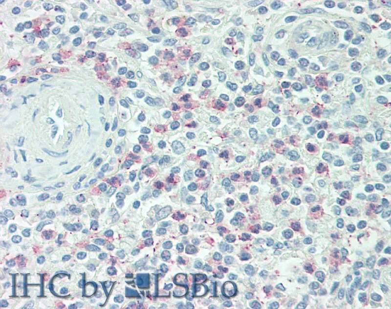 Macrophage Inflammatory Protein 3 Beta (MIP3b) Rat Polyclonal Antibody