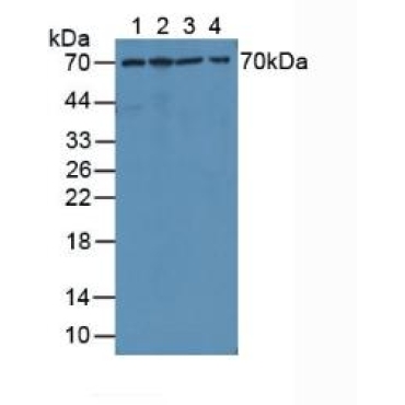 Matrix Metalloproteinase 1 (MMP1) Human Polyclonal Antibody
