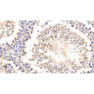 Matrix Metalloproteinase 1 (MMP1) Mouse Polyclonal Antibody