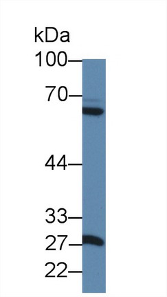 Matrix Metalloproteinase 1 (MMP1) Rat Polyclonal Antibody