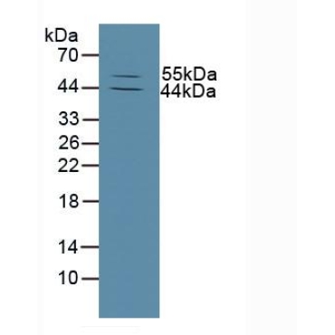 Matrix Metalloproteinase 13 (MMP13) Human Polyclonal Antibody