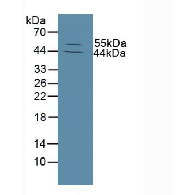 Matrix Metalloproteinase 13 (MMP13) Human Polyclonal Antibody