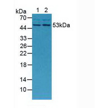 Matrix Metalloproteinase 13 (MMP13) Mouse Polyclonal Antibody
