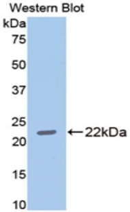 Matrix Metalloproteinase 13 (MMP13) Rat Polyclonal Antibody