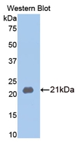 Matrix Metalloproteinase 13 (MMP13) Rabbit Polyclonal Antibody