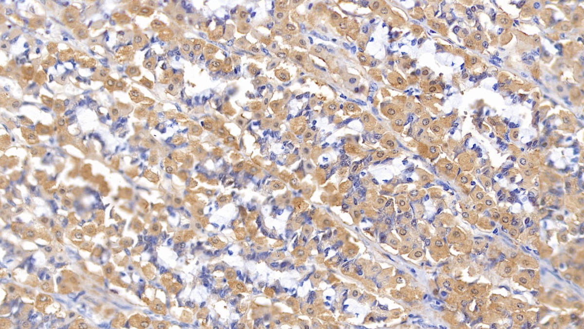 Matrix Metalloproteinase 2 (MMP2) Rat Polyclonal Antibody