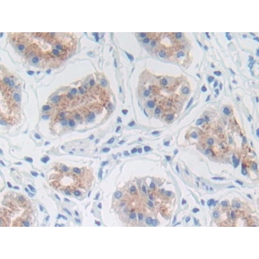 Matrix Metalloproteinase 3 (MMP3) Human Polyclonal Antibody