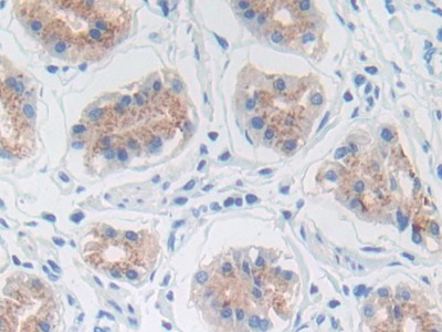 Matrix Metalloproteinase 3 (MMP3) Human Polyclonal Antibody