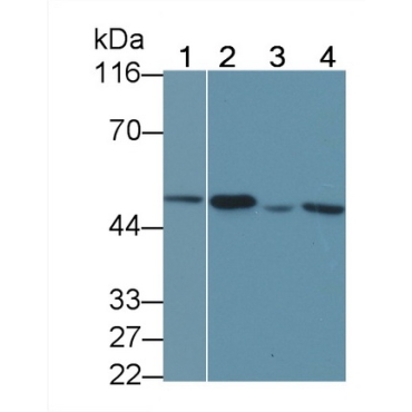 Matrix Metalloproteinase 3 (MMP3) Human Polyclonal Antibody
